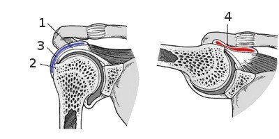 folyadék az acromioclavicularis ízületkezelésben